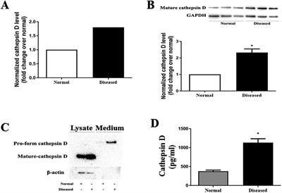 Cathepsin D elevates the fibrocalcific activity in human aortic valve cells through the ERK1/2-Sox9 pathway